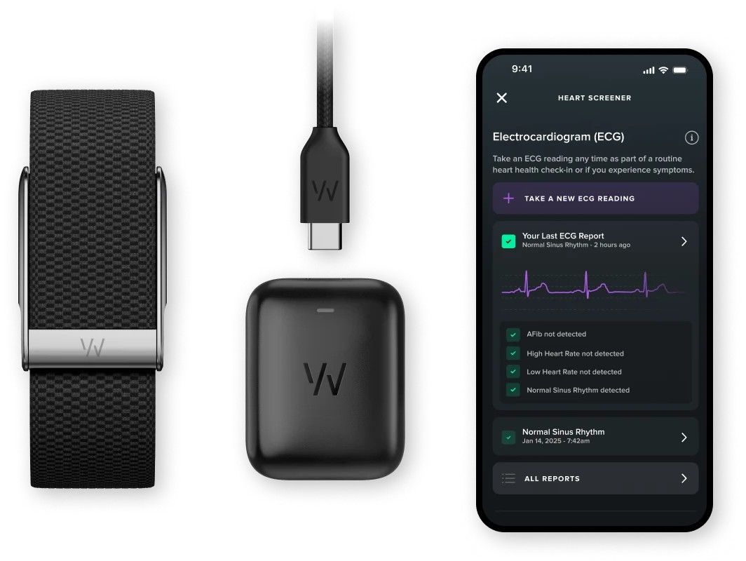 картинка Фитнес-браслет Whoop MG Life Health & Fitness Tracker Obsidian Titanium от магазина КомпьютерЦентр